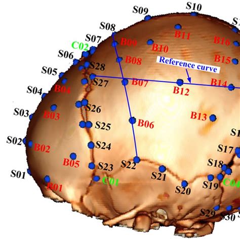 measuring skull thickness|skull thickness chart.